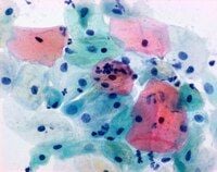 Merck 106888 Papanicolaou solüsyonu 2A orange G solüsyonu (OG6) CE 2,5 lt.